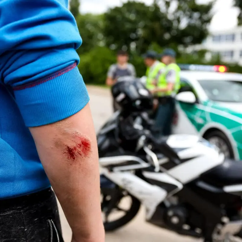 motorcycle accident lawsuit