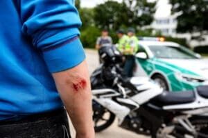 motorcycle accident lawsuit