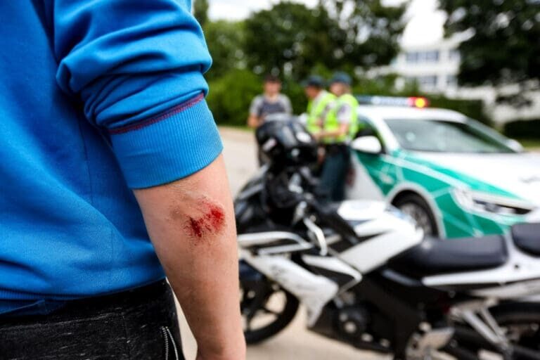 demanda por accidente de moto